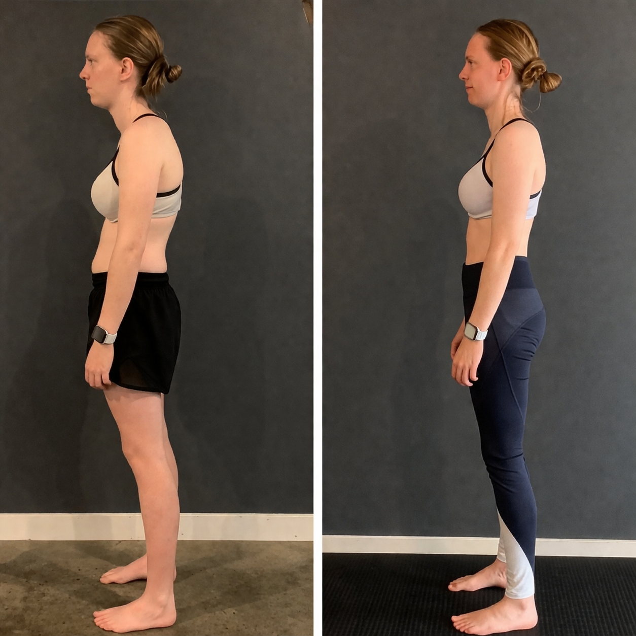 NuPoise Posture Retrainer